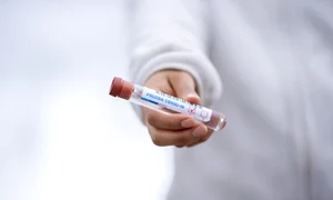 test tube 5065426 1920 1 jpeg