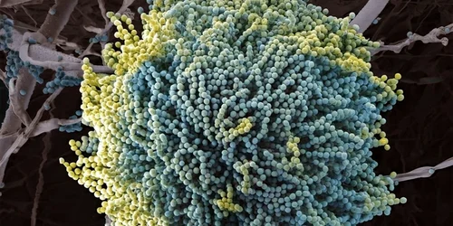aspergillus fungus scanning electron microscopy 600nw 2558068481 webp